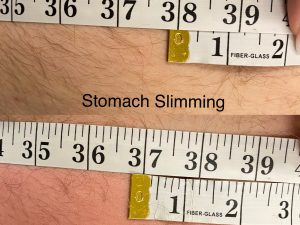 stomach slimming